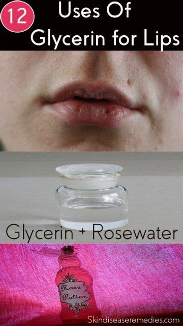can glycerin be used on lips at home