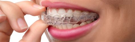 can invisalign be used instead of braces