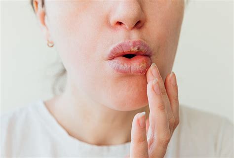 can kissing someone make your lips swelling hurt