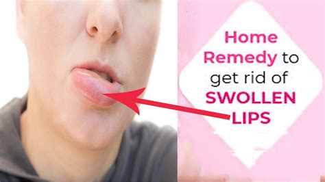 can lips get swollen after making out without