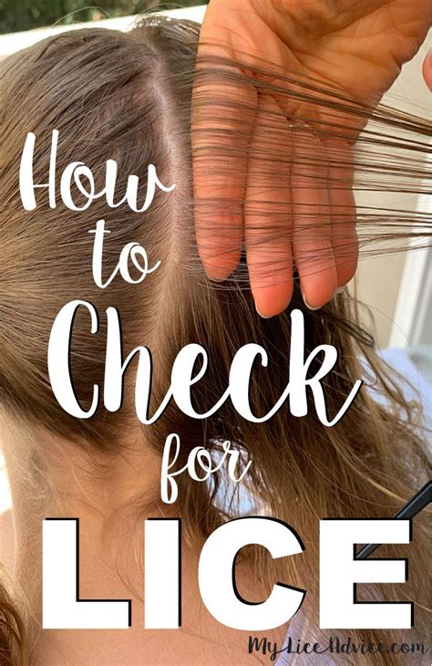 can you check yourself for head lice