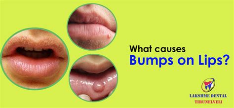 can you get a bump on your lip