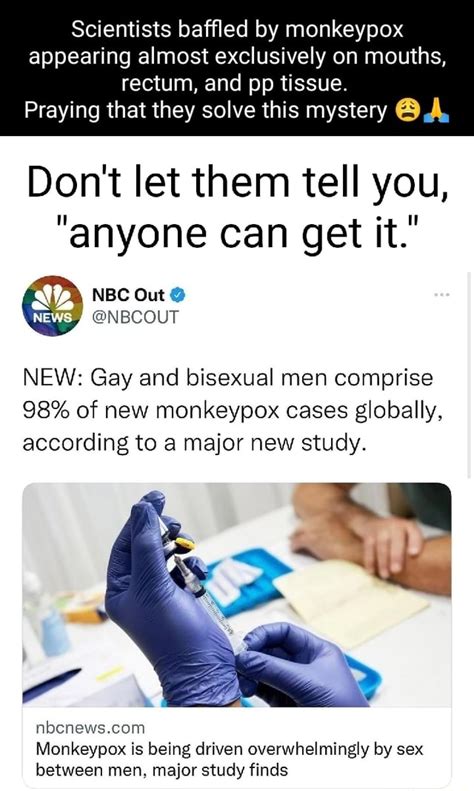 can you get monkeypox from being gay