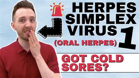 can you kiss someone with herpes simplex 2