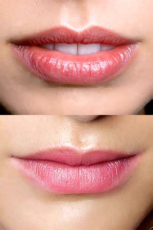 can your lips get thinner every two