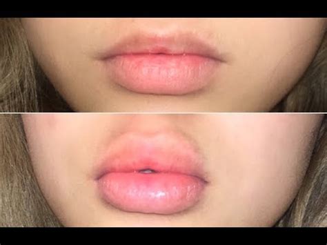 can your lips grow from kissing another