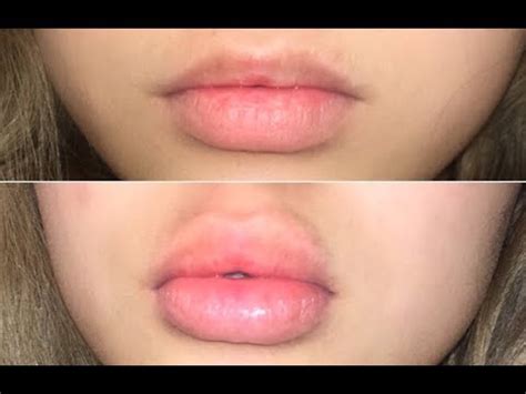 can your lips grow from kissing someone youtube