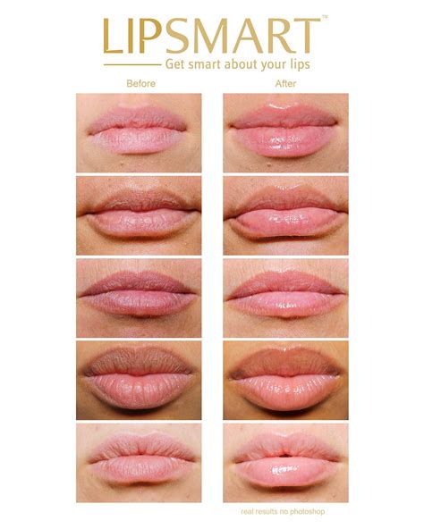 can your lips grow mold without