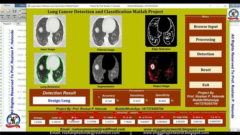 Cancer Classification Using Matlab