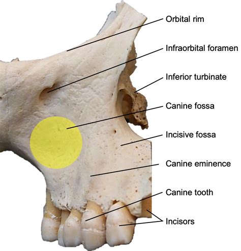 Canine Fossa Boundaries