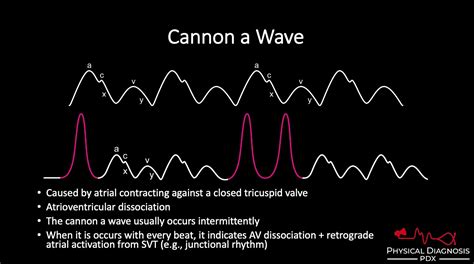 Cannon A Waves