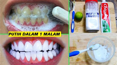cara alami memutihkan gigi kuning dan berkarang