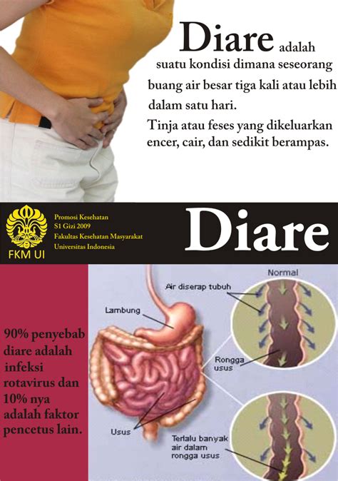 cara mengatasi diare