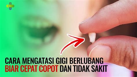 Cara Mengatasi Gigi Berlubang   10 Cara Mengatasi Gigi Berlubang Yang Ampuh Dan - Cara Mengatasi Gigi Berlubang