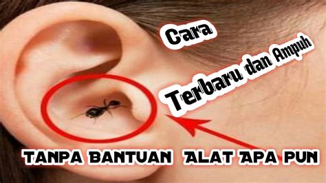 cara mengeluarkan semut dari telinga