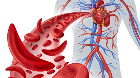 Cara Mengetahui Penyumbatan Pembuluh Darah Jantung Cara Mengetahui Penyumbatan Pembuluh Darah Jantung - Cara Mengetahui Penyumbatan Pembuluh Darah Jantung