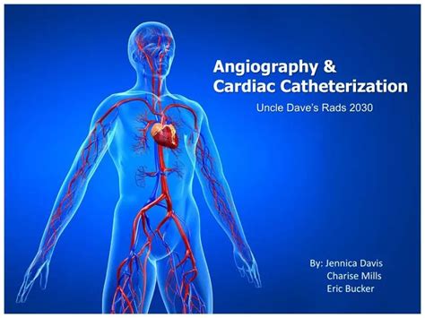 Cardiac Catheterization Ppt