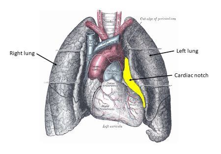 Cardiac Notch