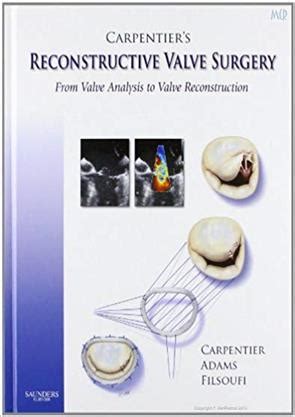 Read Carpentiers Reconstructive Valve Surgery From Valve Analysis To Valve Reconstruction 