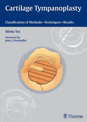 Cartilage Tympanoplasty Classifications Of Method
