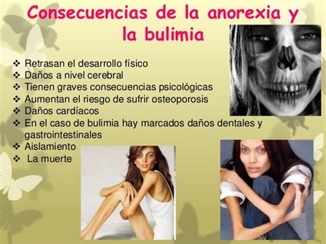 causas de la bulimia y anorexia pdf