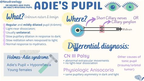 causes of adies pupil
