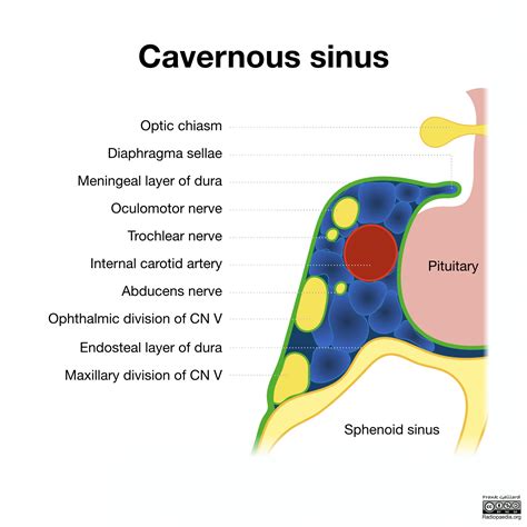 cavernous sinus