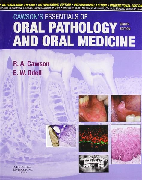 Download Cawsons Essentials Of Oral Pathology And Oral Medicine 8E 