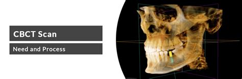 Cbct Full Form In Electrical