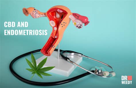 cbd endometriosis