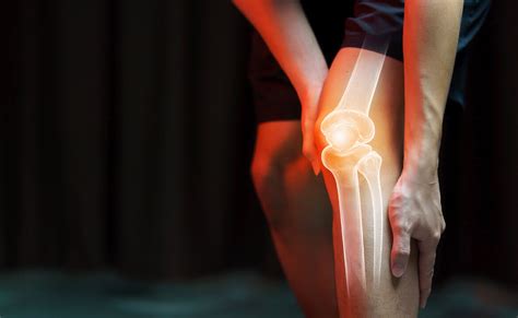 Ceea ce ar durere în genunchi
