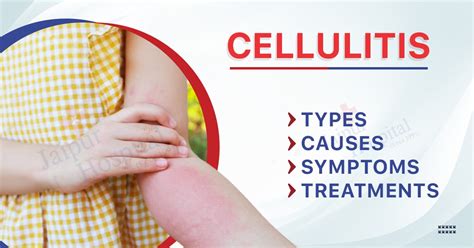 Cellulitis