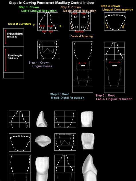 central tooth carving manual
