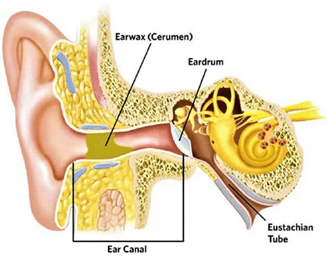 Cerumen Impaction Icd 10