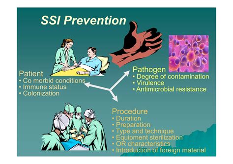 Characteristics Of Ssi