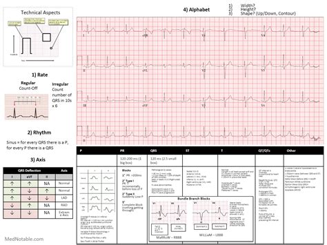 Cheat Sheet 12 Lead Ecg Interpretation