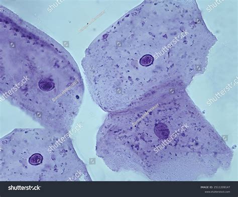 Cheek Cell Under Microscope