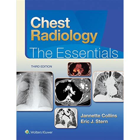 Chest Radiology The Essentials