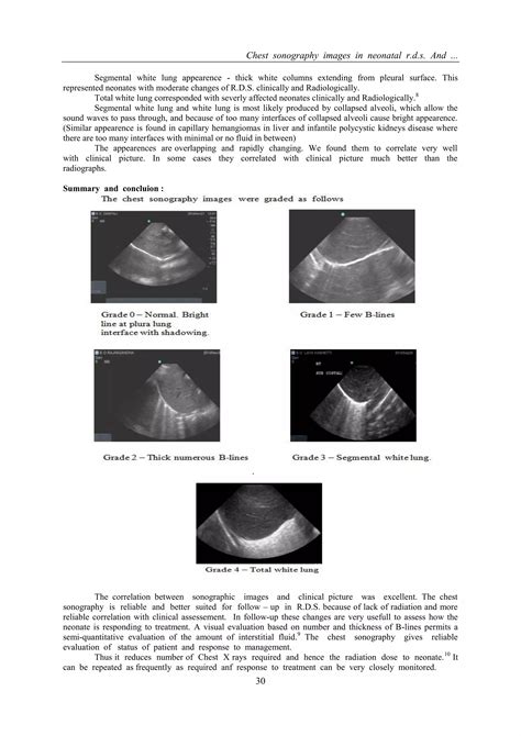 Chest Sonography