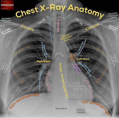 Chest X Ray Cpt Code