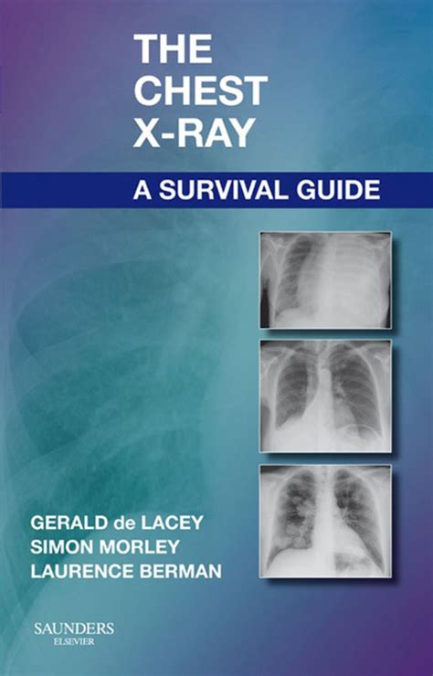 Download Chest X Ray Survival Guide 