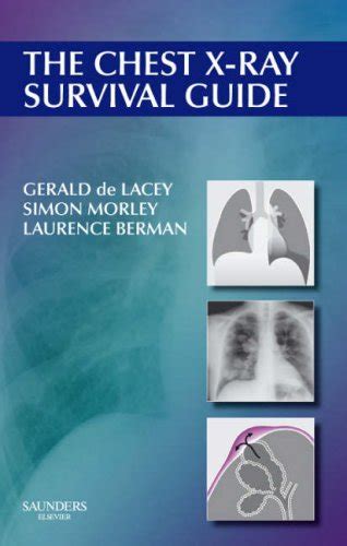 Download Chest X Ray Survival Guide 