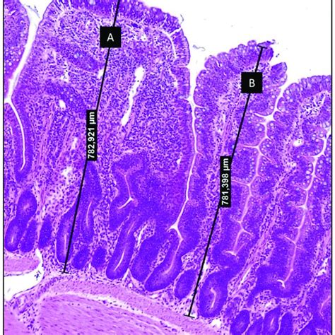 Chicken Proxy Ileum
