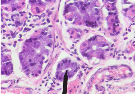 Chief Cells Secrete