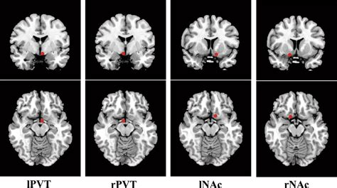 Children With Brain Dysfunction Neurology Cognition Language And Behavior