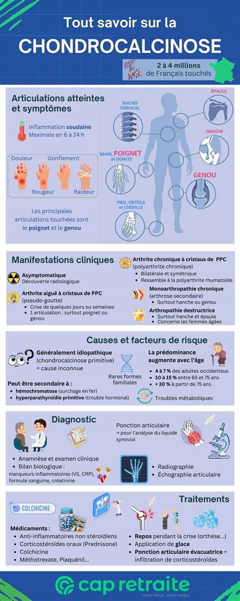 Chondrocalcinose Du Genou