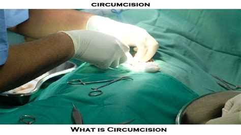 circumcision