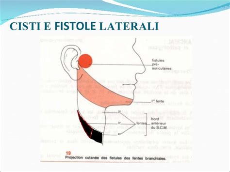 Cisti Del Collo