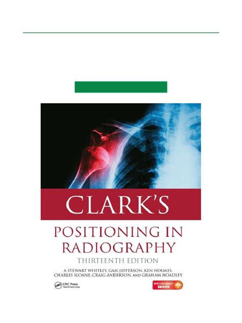 clark positioning in radiography