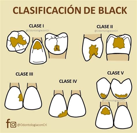 Clases De Black